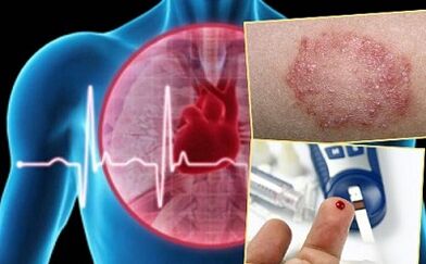 Contraindicaciones para la autoridad labial